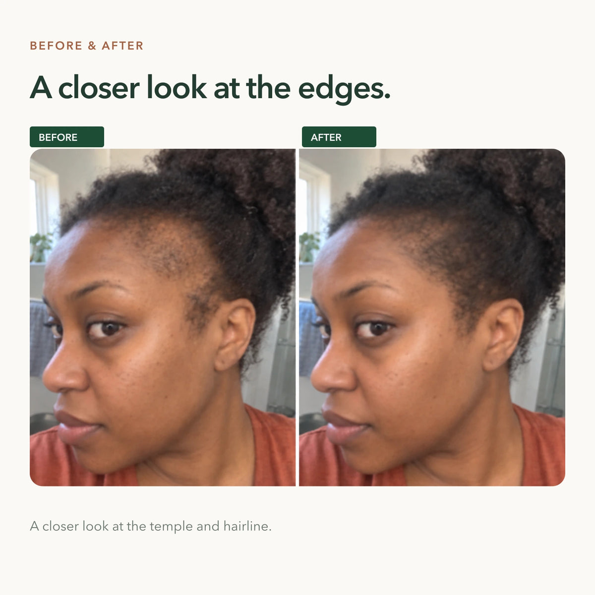 AI-generated before-and-after concept of Black women’s edges, not customer photos or Follica results